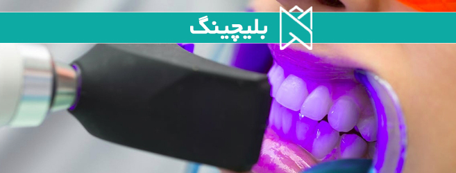 بلیچینگ دندان